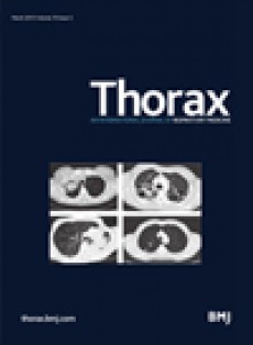 Thorax